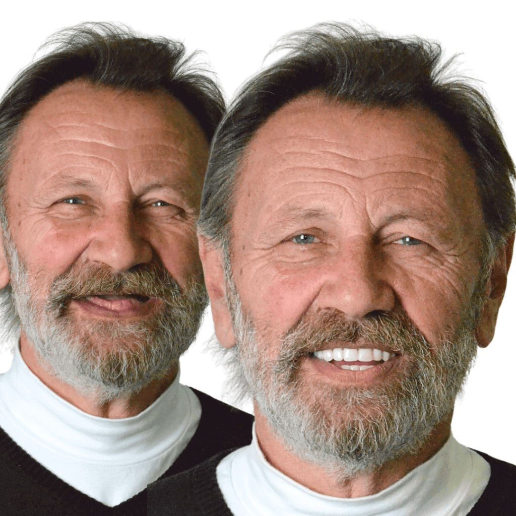 Proteze na drikerima - pre i posle