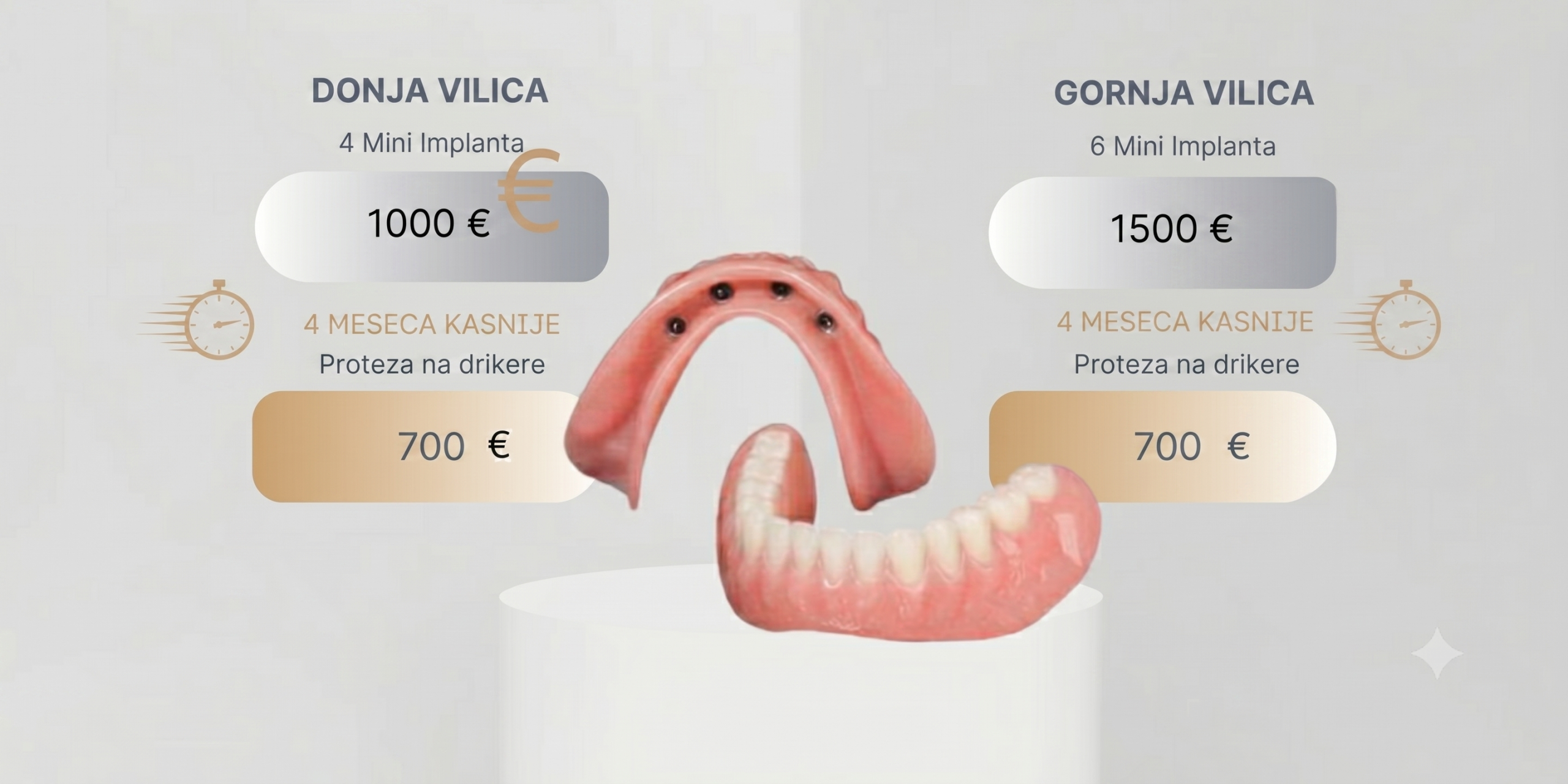 Mini implanti cene i proteza na drikere za gornju i donju vilicu stomatologija radlovacki